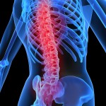 osteoporoz-kemik-erimesi-nedir
