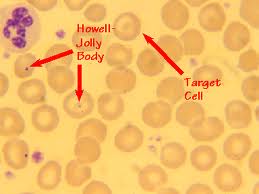 Howell-Jolly