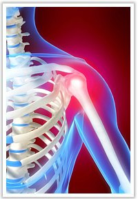 Rotator Cuff Tendiniti (Omuz Manşet Kaslarının İltihabı)