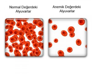 Anemi Nedir? Anemi Nedenleri Nelerdir?