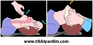 CPR