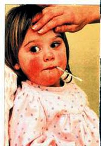 Çocukta Ateş Nedenleri? Ateş Neden olur ?