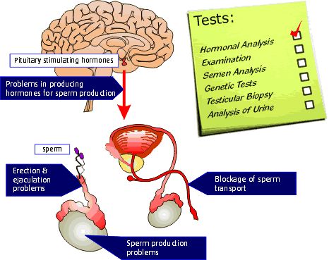 Erkek Kısırlığının Tanısında Diğer Yöntemler?