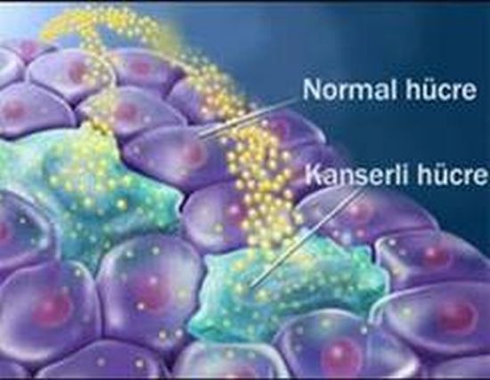 Kanser Nedir ? Nasıl Oluşur ? Nasıl Korunabiliriz?