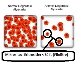 Kan Periferik Yaymada Saptanan Bulgular ve Anlamları ( Doktorlar için )