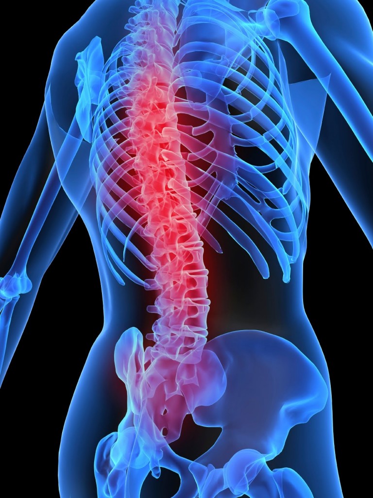 Osteoporoz ( Kemik Erimesi ) Nedir ?