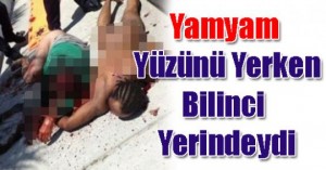 yuzunu_yerken_bilinci_yerindeydi_h14872